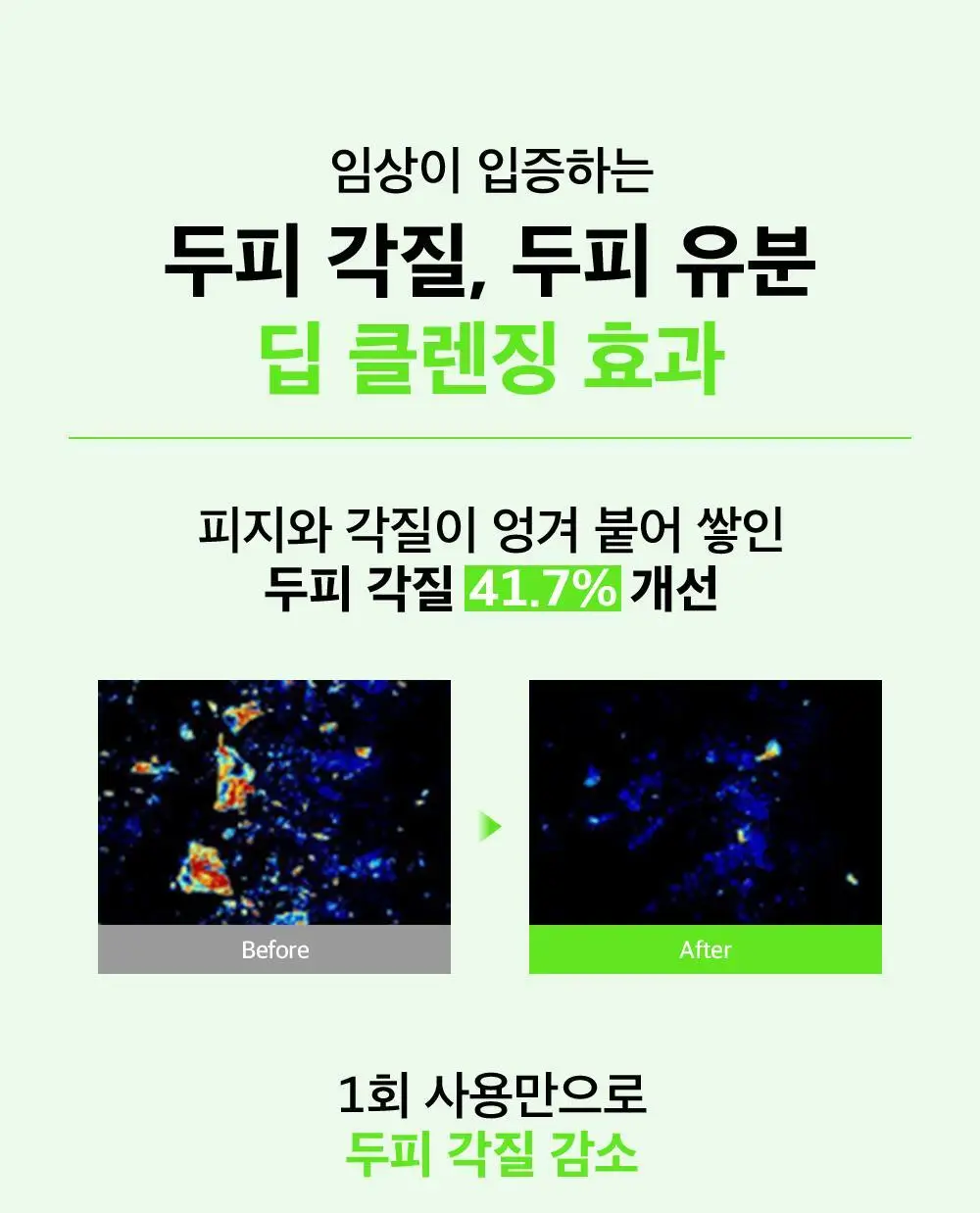 [대용량] 더마비 프레쉬 스칼프 클리어 샴푸 1000ml 2종 택 1 (베르가못그린/플로럴그린) 상세페이지 10